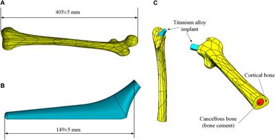 Parametric Design of Hip Implant With Gradient Porous Structure